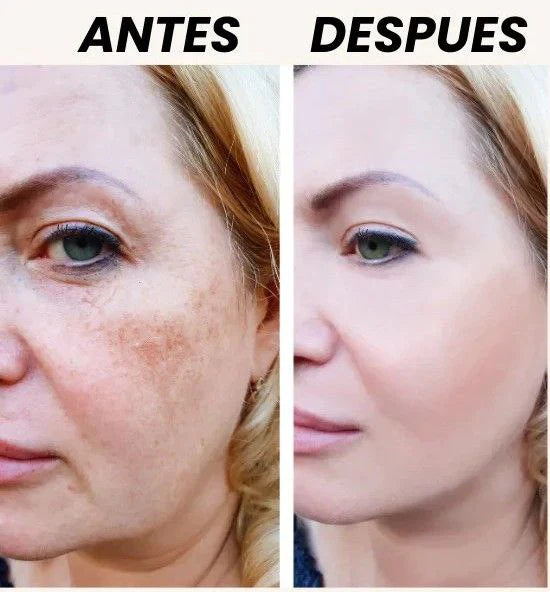 ✨Zamia Crema Aclarante: Despídete de las manchas y luce una piel uniforme🌸