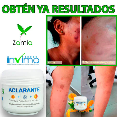 ✨Zamia Crema Aclarante: Despídete de las manchas y luce una piel uniforme🌸
