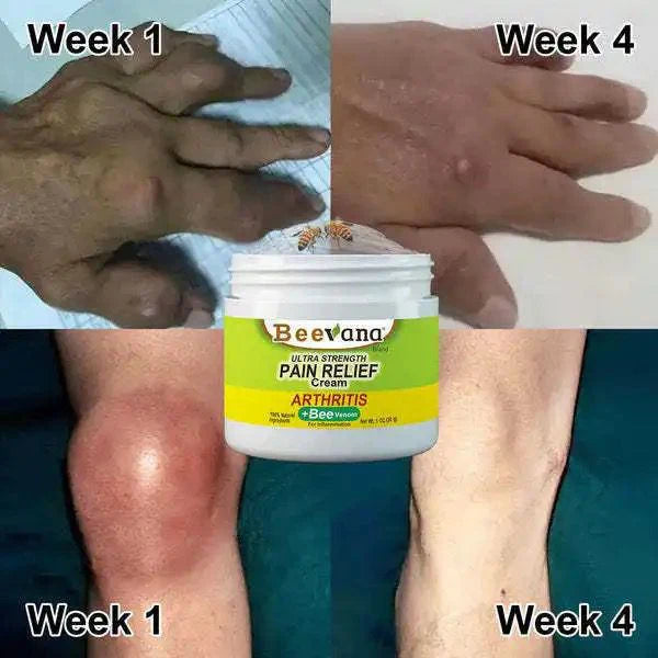 ✨BEEVANA CREMA PARA TERAPIA DE HUESOS Y ARTICULACIONES