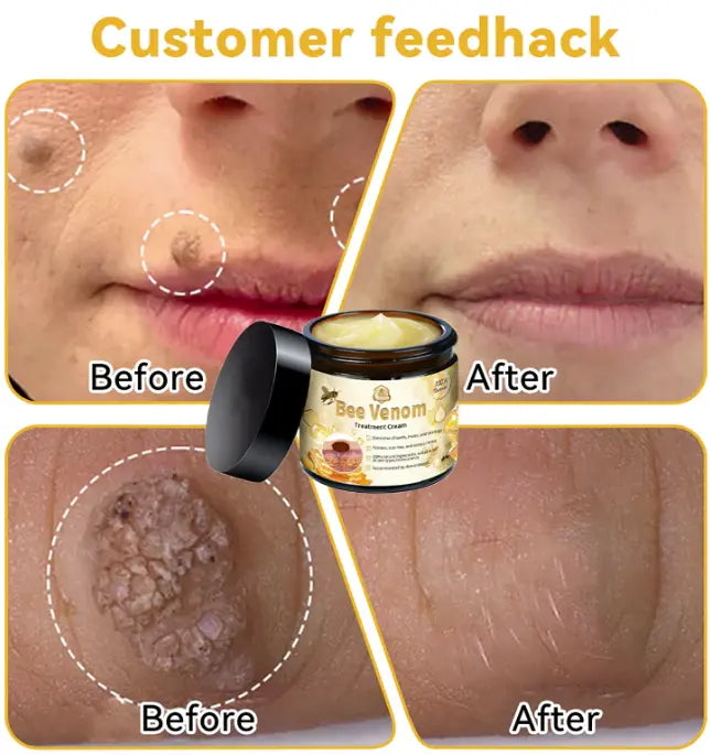 🌿Crema Bee Venom ✨Potencia tu belleza desde la raíz
