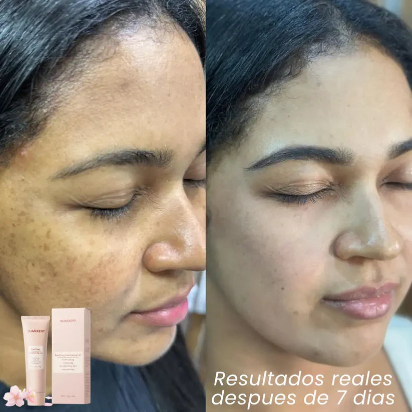 😍Paga 1 - Lleva 2🎁 ✨GEL EXFOLIANTE ACLARADOR