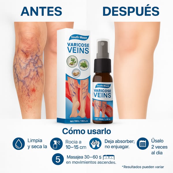 😍Paga 1 y lleva 2🎁 🌿Varicose Veins ✨¡Clínicamente probado para eliminar las venas varicosas✅
