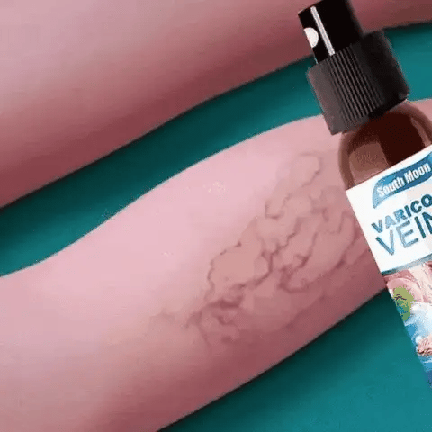 🌿Varicose Veins ✨¡Clínicamente probado para eliminar las venas varicosas✅