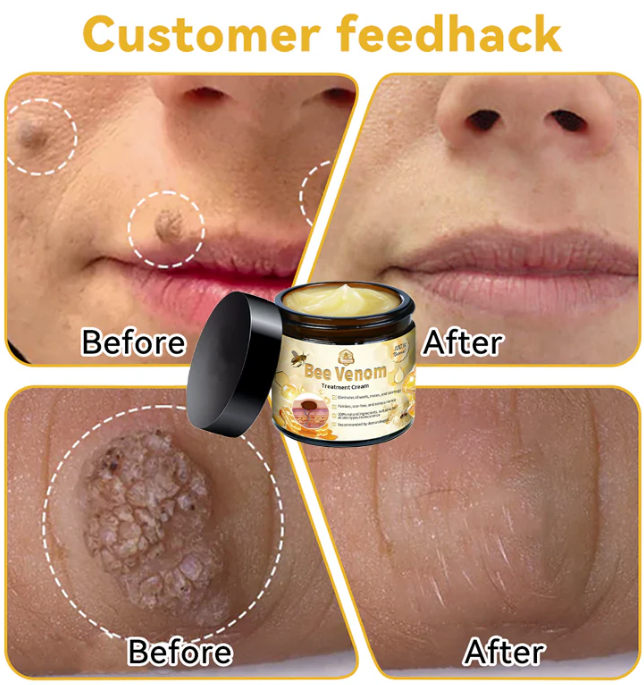 ✨Crema Tratamiento BEE VENOM | 🎁 Paga 1 - Lleva 2 😍