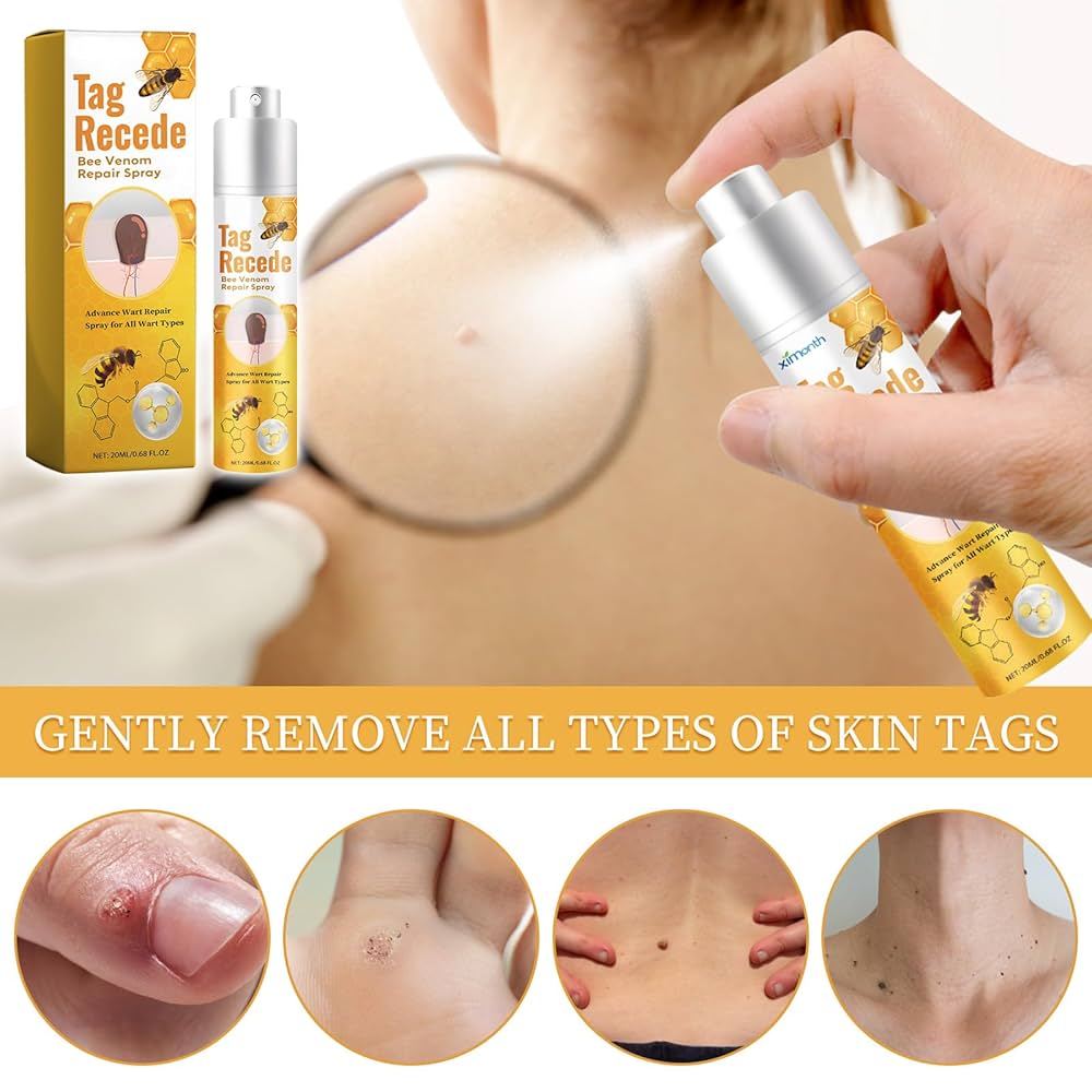 ✨TagRecede Spray Tratamiento Para la Eliminación de Verrugas🌿