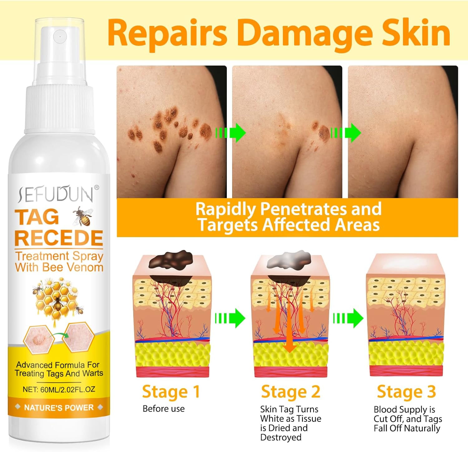 ✨TagRecede Spray Tratamiento Para la Eliminación de Verrugas🌿